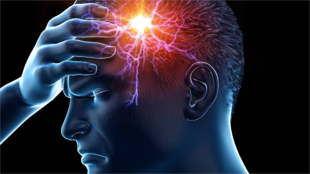 Migraine Relief