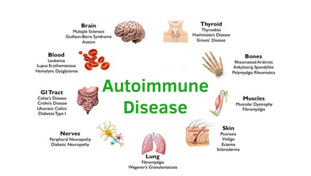 Ayurvedic Approach to Managing Autoimmune Disorders